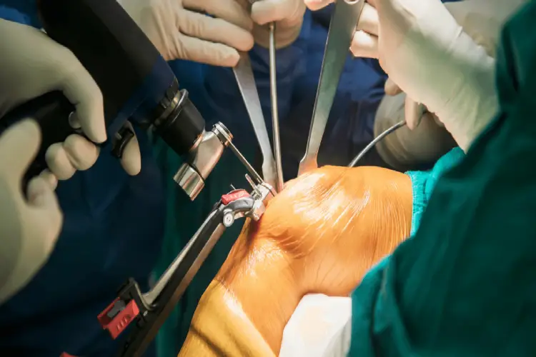 Conventional Joint Replacement
