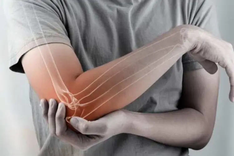 Elbow Replacement