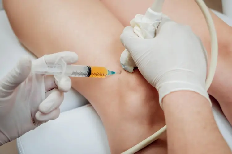 PRP Therapy